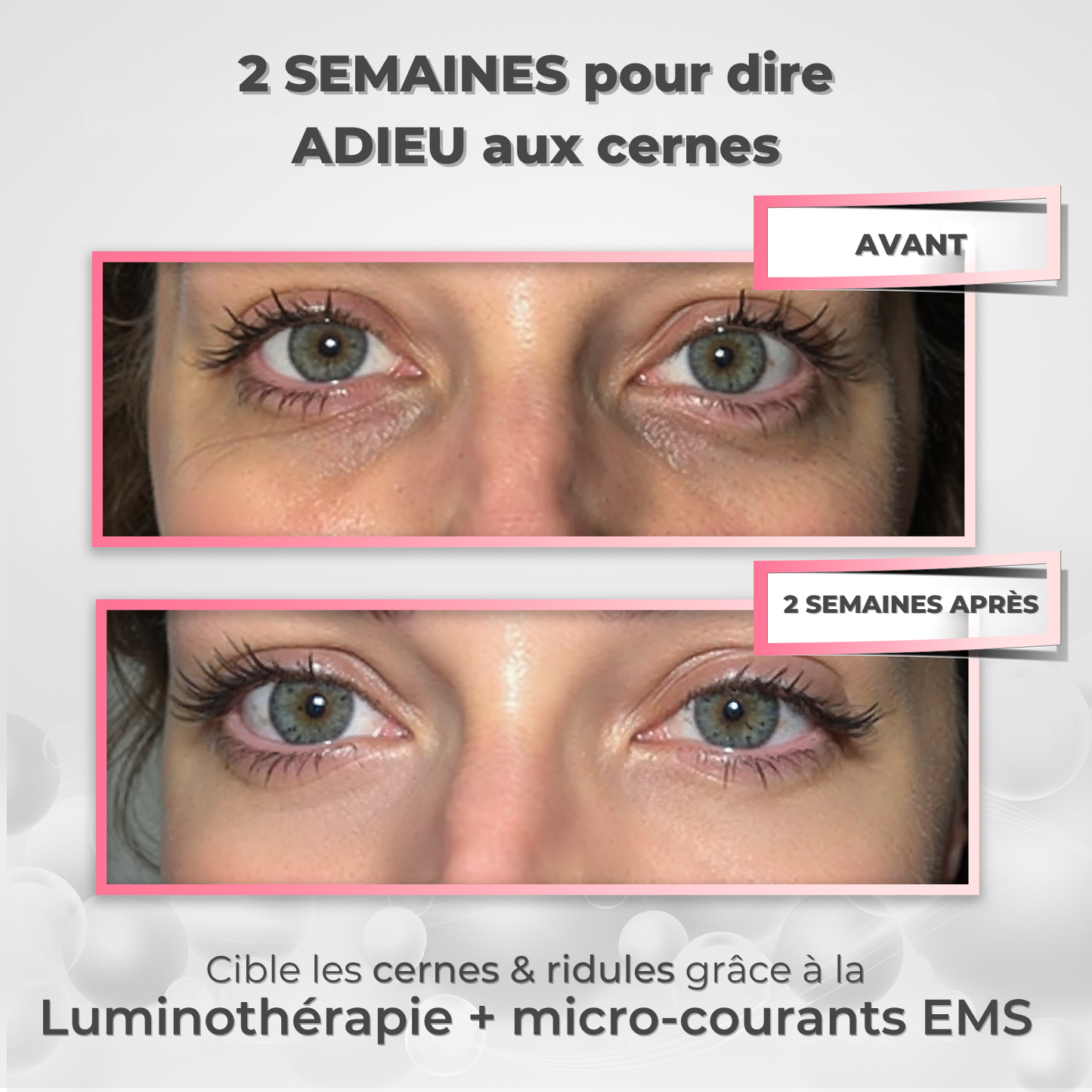 Lunettes Eyeonic™